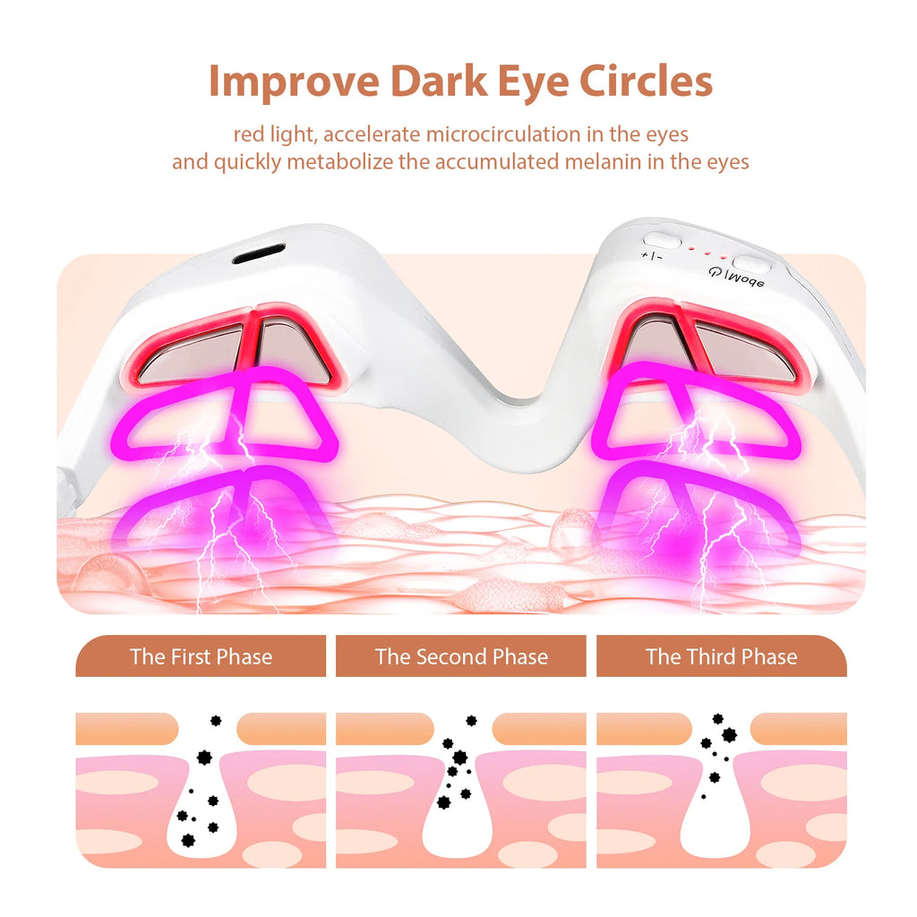 Smart EMS Red Light Eye Massager – Anti-Aging Treatment for Dark Circles & Wrinkles